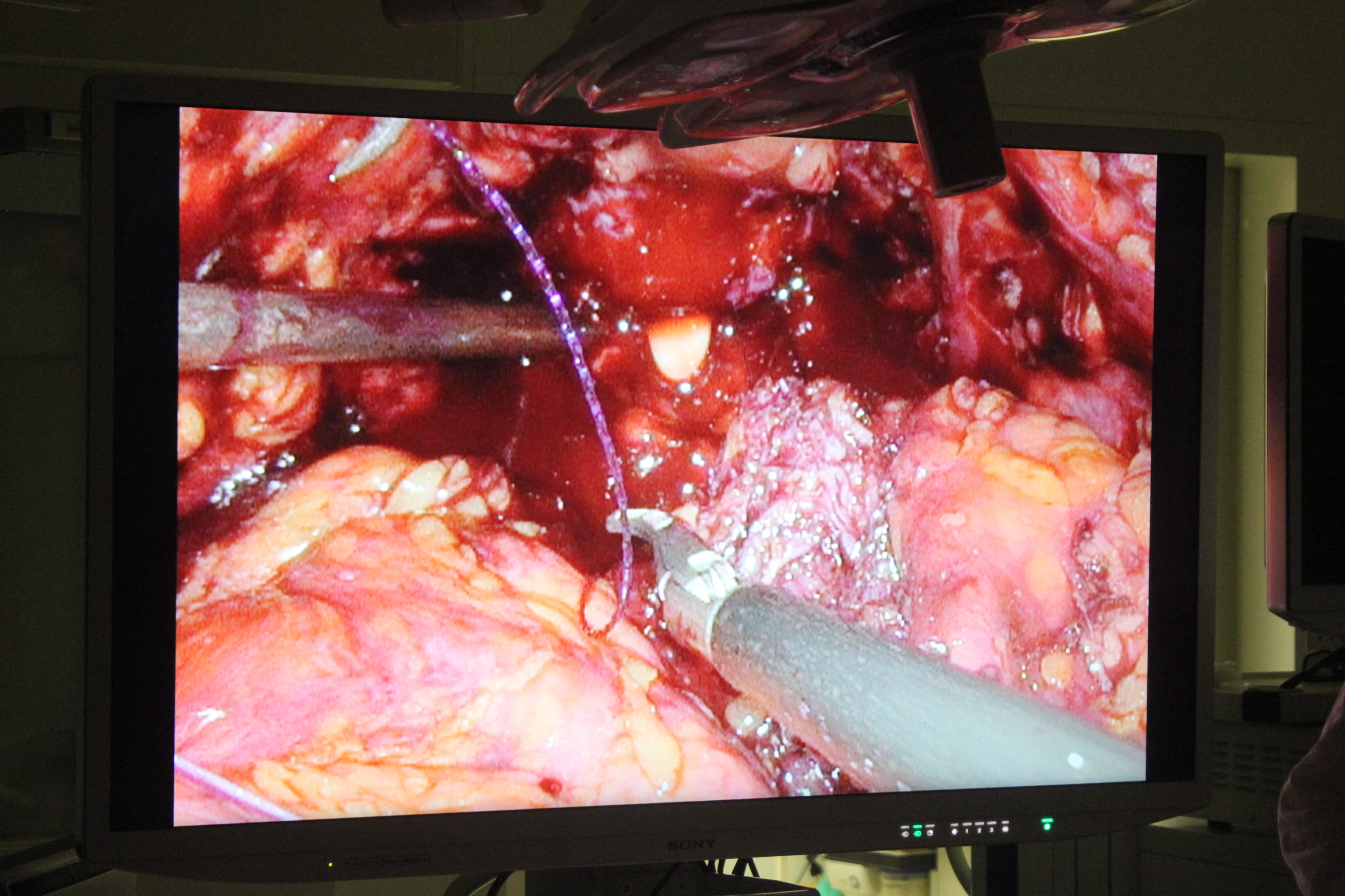 the image from the endoscope